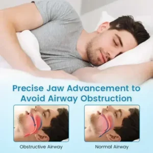 Anti-Snoring & Anti-Grinding Teeth Protector