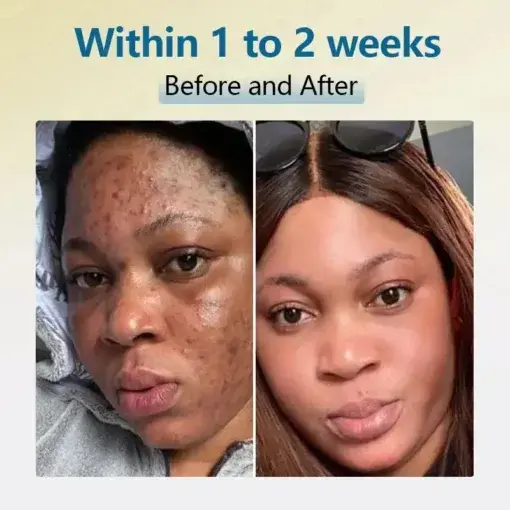 Bean Essence Serum