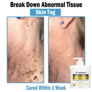 Bee Bright Multi-Symptom Skin Treatment Cream