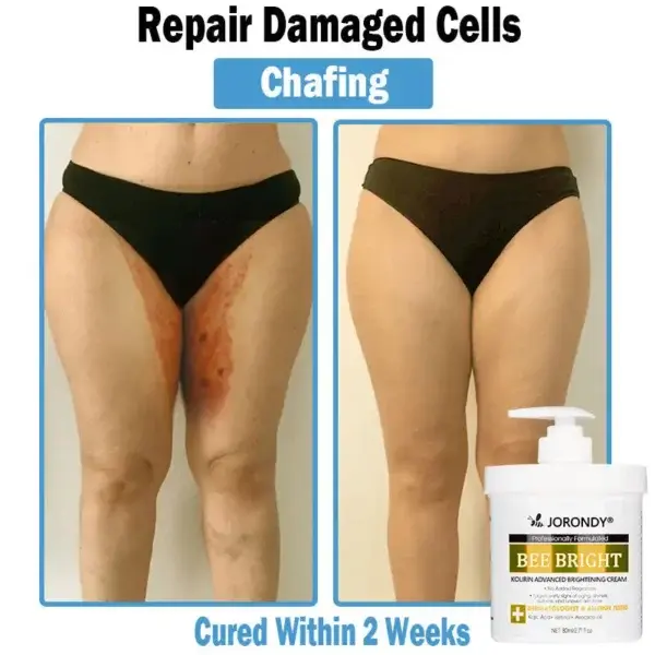 Bee Bright Multi-Symptom Skin Treatment Cream