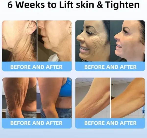 Bee Toxin Lift Cream