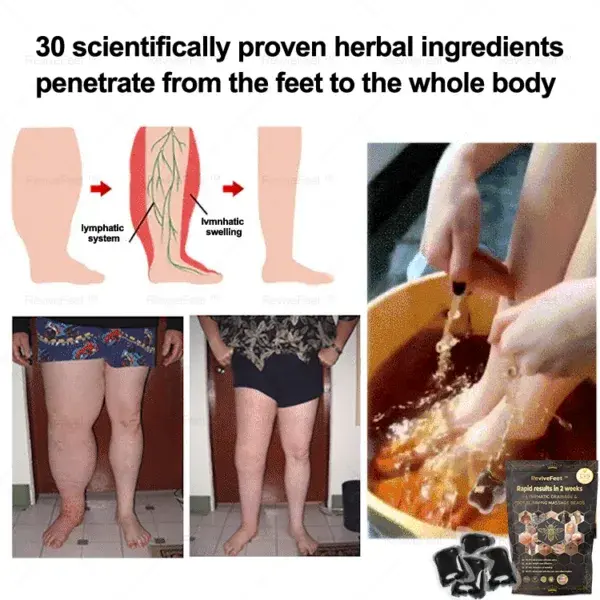 Bee Venom Lymphatic Drainage & Slimming Foot SoakBeads
