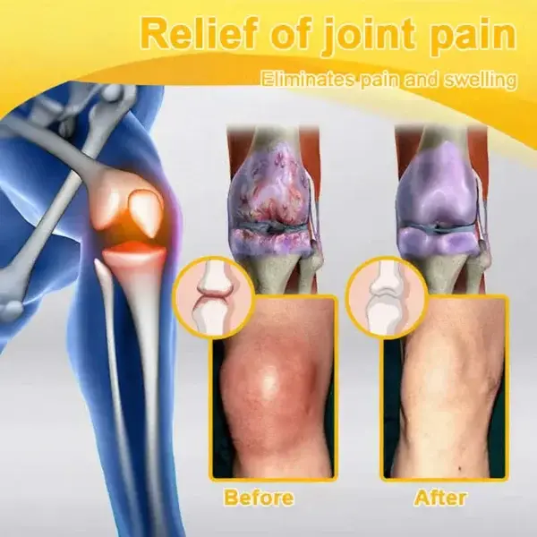 Bee Venom Pain-Relief Bone Healing Spray