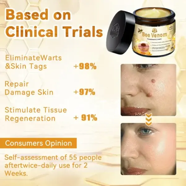 Bee Venom Skin Treatment Cream
