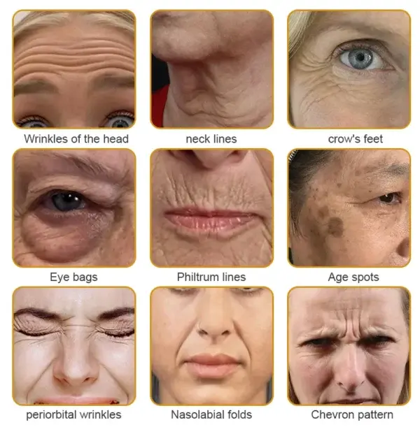 Botulin Bee Poison Wrinkle Removal Cream