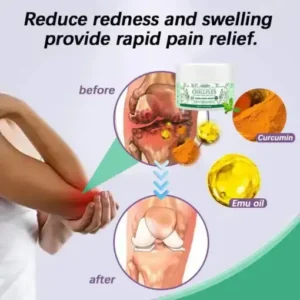 CHILLFLEX Herbal Pain Relief Cream