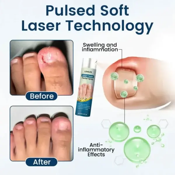 Fungal Repair Herbal Spray