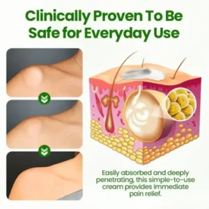 KnotAway Lipoma Removal Cream