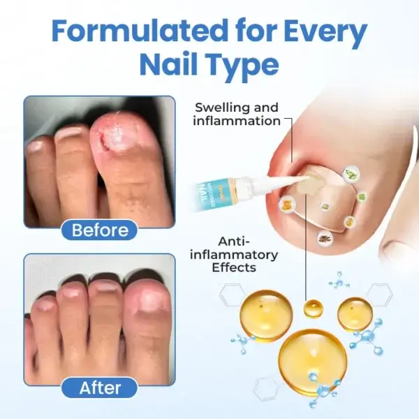 MycoErase Nail Revive Pen