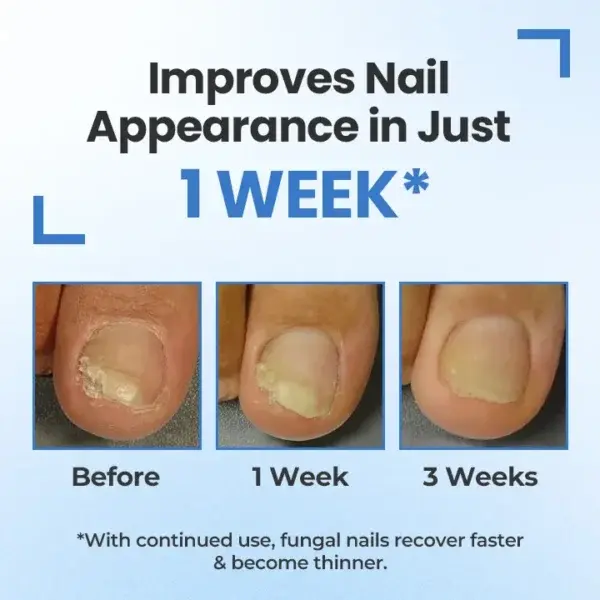 MycoErase Nail Revive Pen