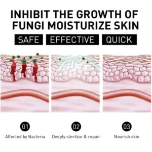 Psoriasis Cure Cream