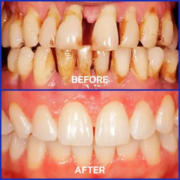 VioGloss Bienengift-Zahntherapie Oral Power