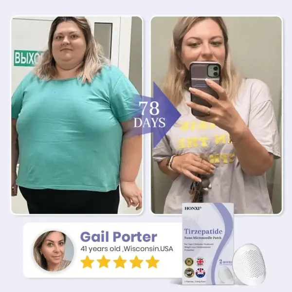 𝗡𝗮𝗻𝗼 𝗠𝗶𝗰𝗿𝗼𝗻𝗲𝗲𝗱𝗹𝗲 𝗣𝗮𝘁𝗰𝗵