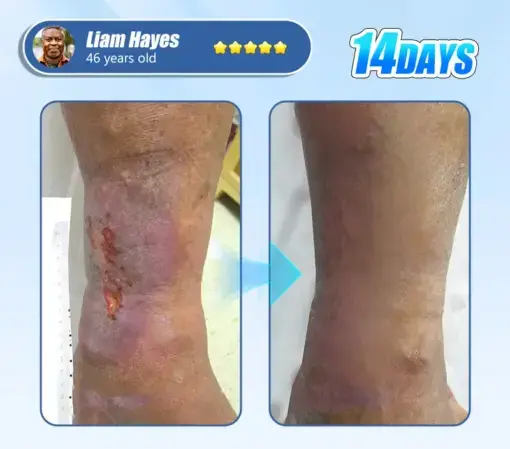 Diabetic Skin Revolution – 6-IN-1 Clinical Solution Black Fridey - Image 3