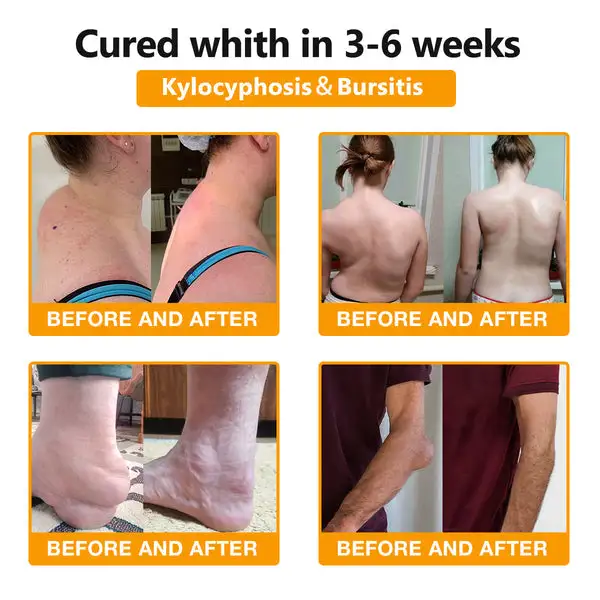 Bee Venom & Turmeric Arthritis Therapy Cream - Image 5