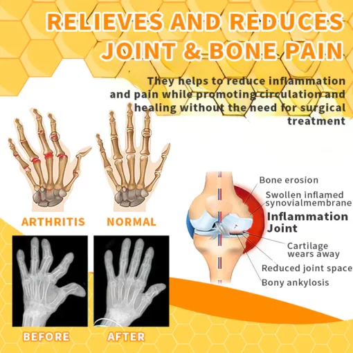 Bee Venom Joint Therapy Pain Relief Gel - Image 3