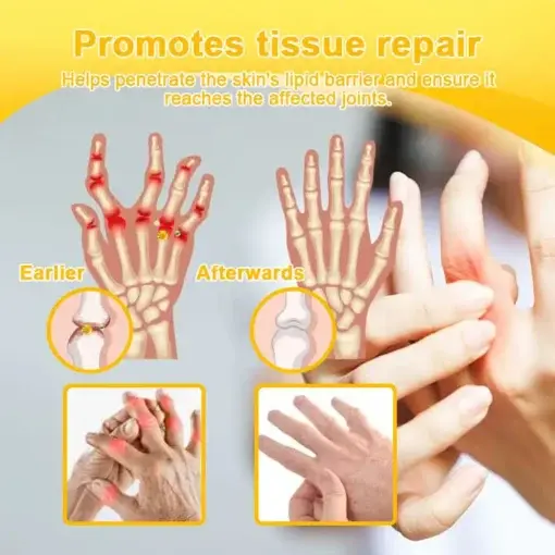 Bee-Venom Pain-Relief Bone Healing Cream - Image 9