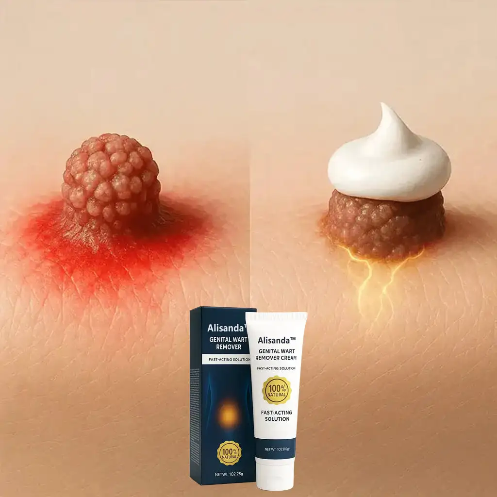|Genital Warts Remover Cream for Men - Image 18