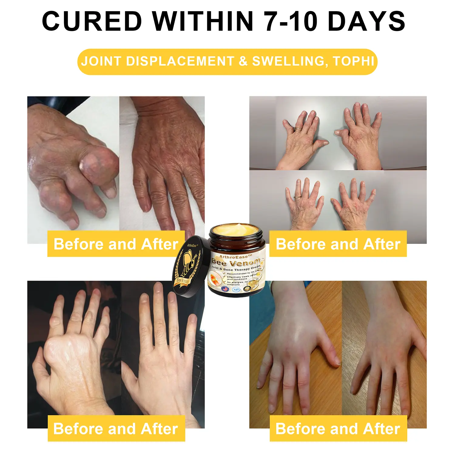 ArthroEase Bee Venom Arthritis Therapy Cream - Image 5