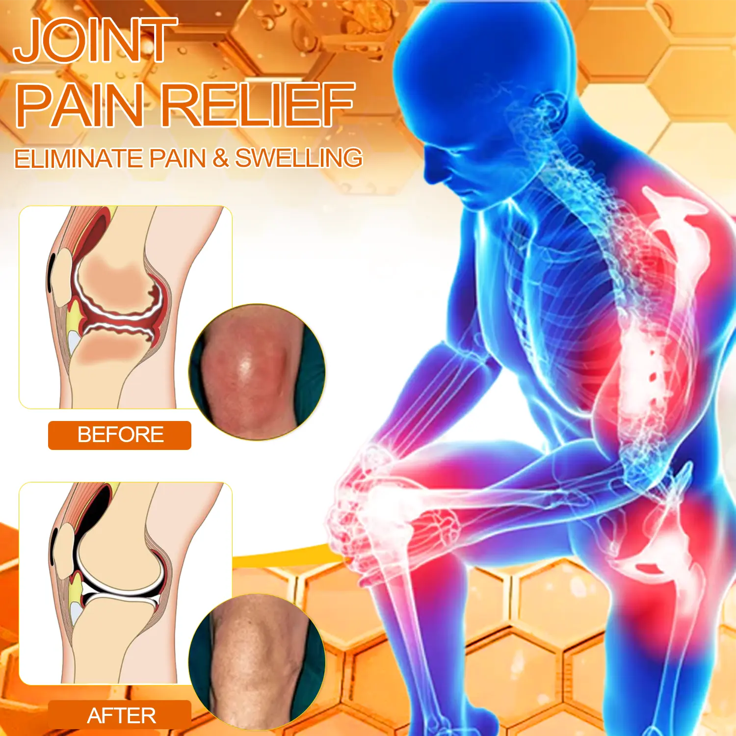 ArthroEase Bee Venom Arthritis Therapy Cream - Image 9