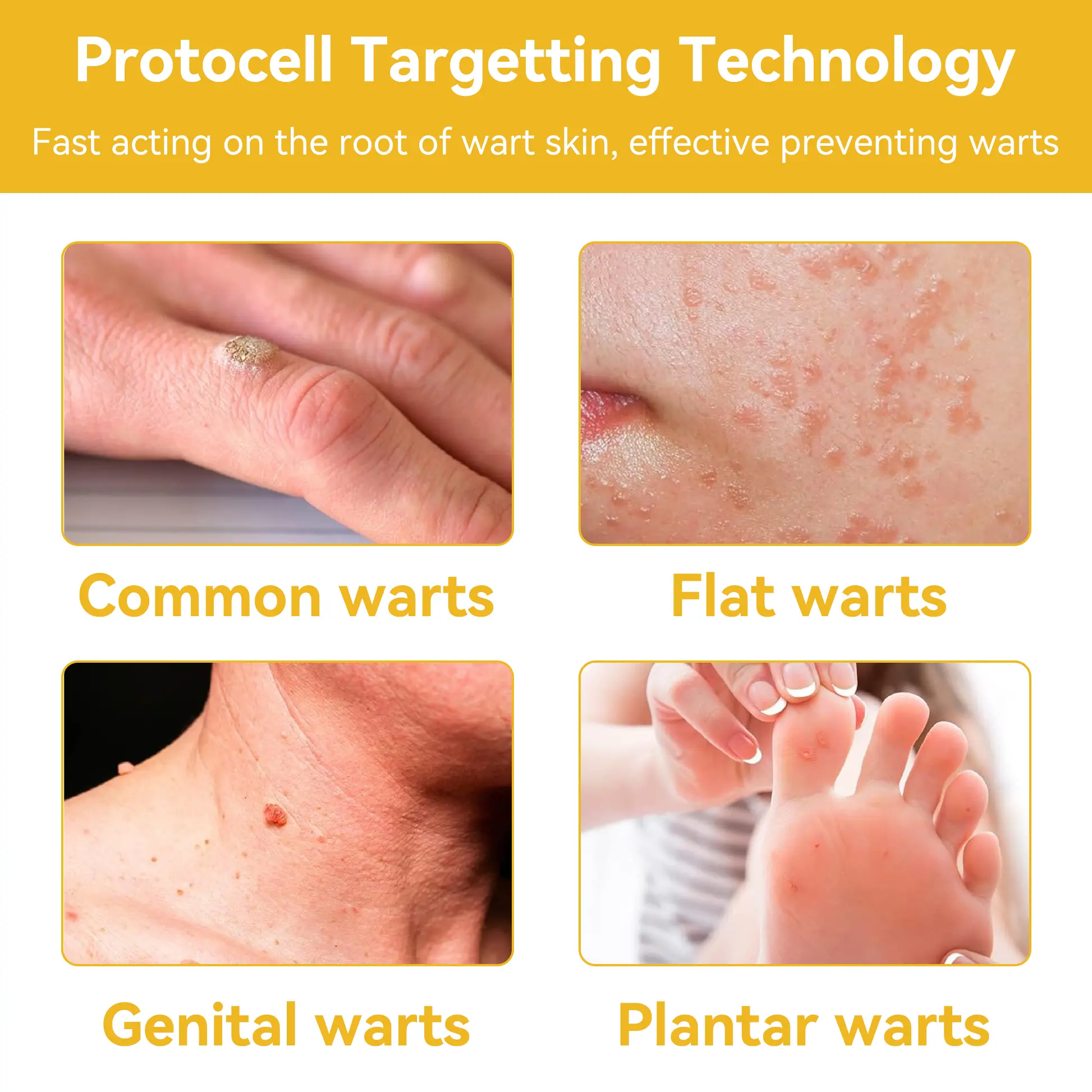 Bee Venom Wart & Moles Removal Cream - Image 18