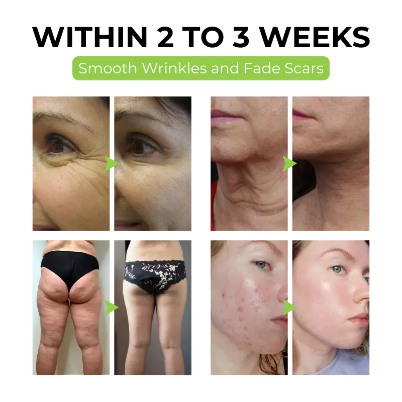 FirmaDerm Collagen Peptide Cream - Image 7