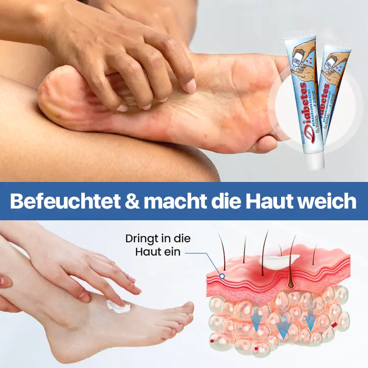 VitaGluco Diabetes-Behandlungscreme - Image 5