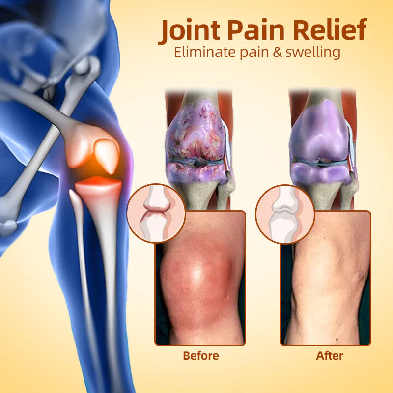 Canadian honey bee Venom Pain and Bone Healing Cream - Image 4