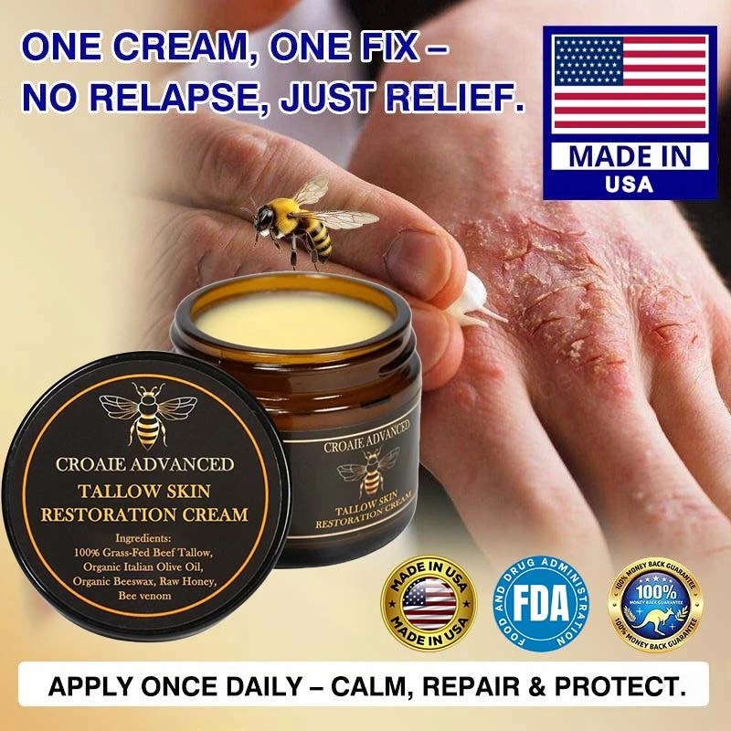 CROAIE 𝐏𝐬𝐨𝐫𝐢𝐚𝐬𝐢𝐬 & 𝐄𝐜𝐳𝐞𝐦𝐚 𝐑𝐞𝐥𝐢𝐞𝐟 𝐂𝐫𝐞𝐚𝐦