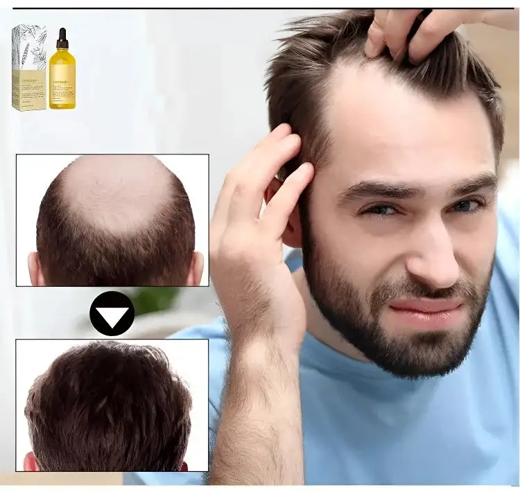 Rosemary Hair Growth Essence - Image 9
