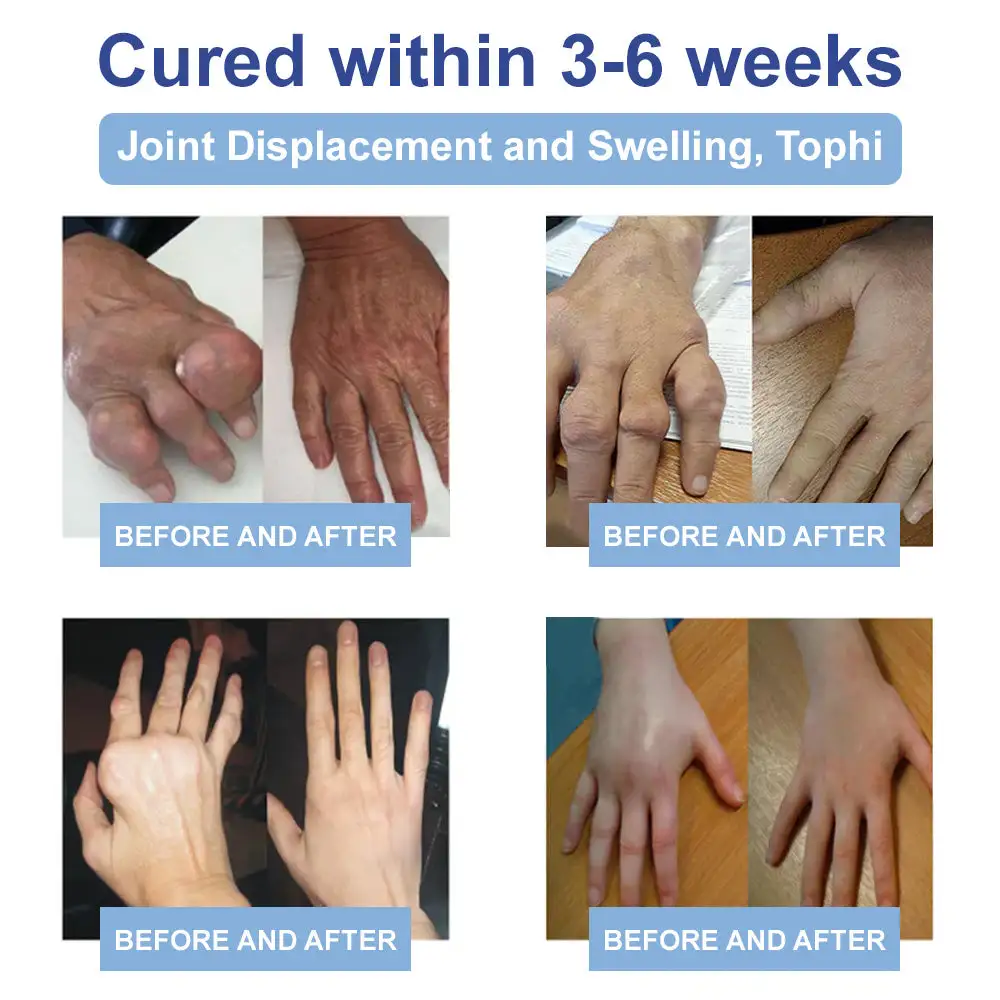 Magnesium Pain Healing Bone Cream - Image 3