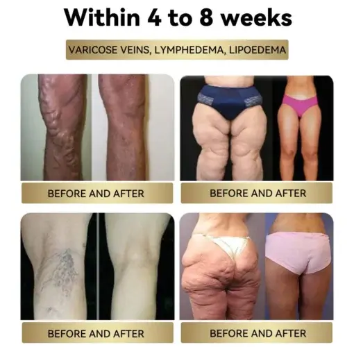 Cyclic Peptide Thermo Slim Cream - Image 3
