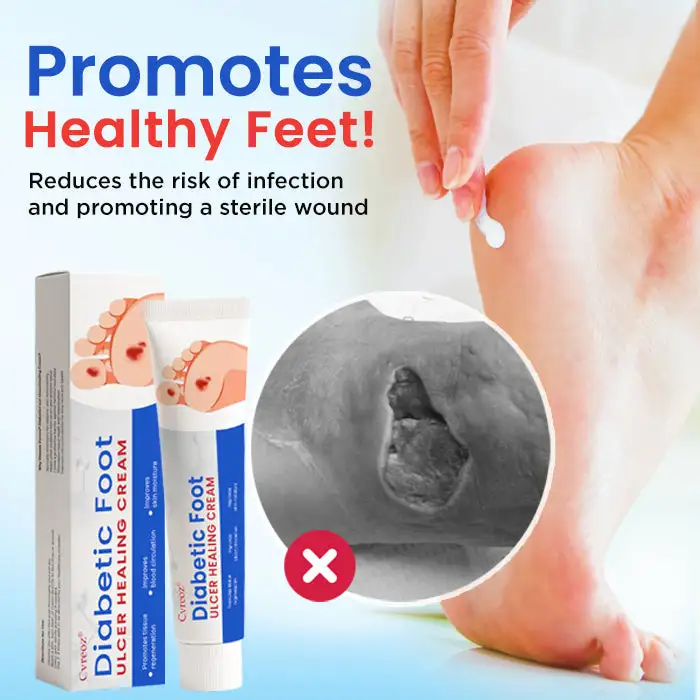 Diabetic Foot Ulcer Healing Cream - Image 6