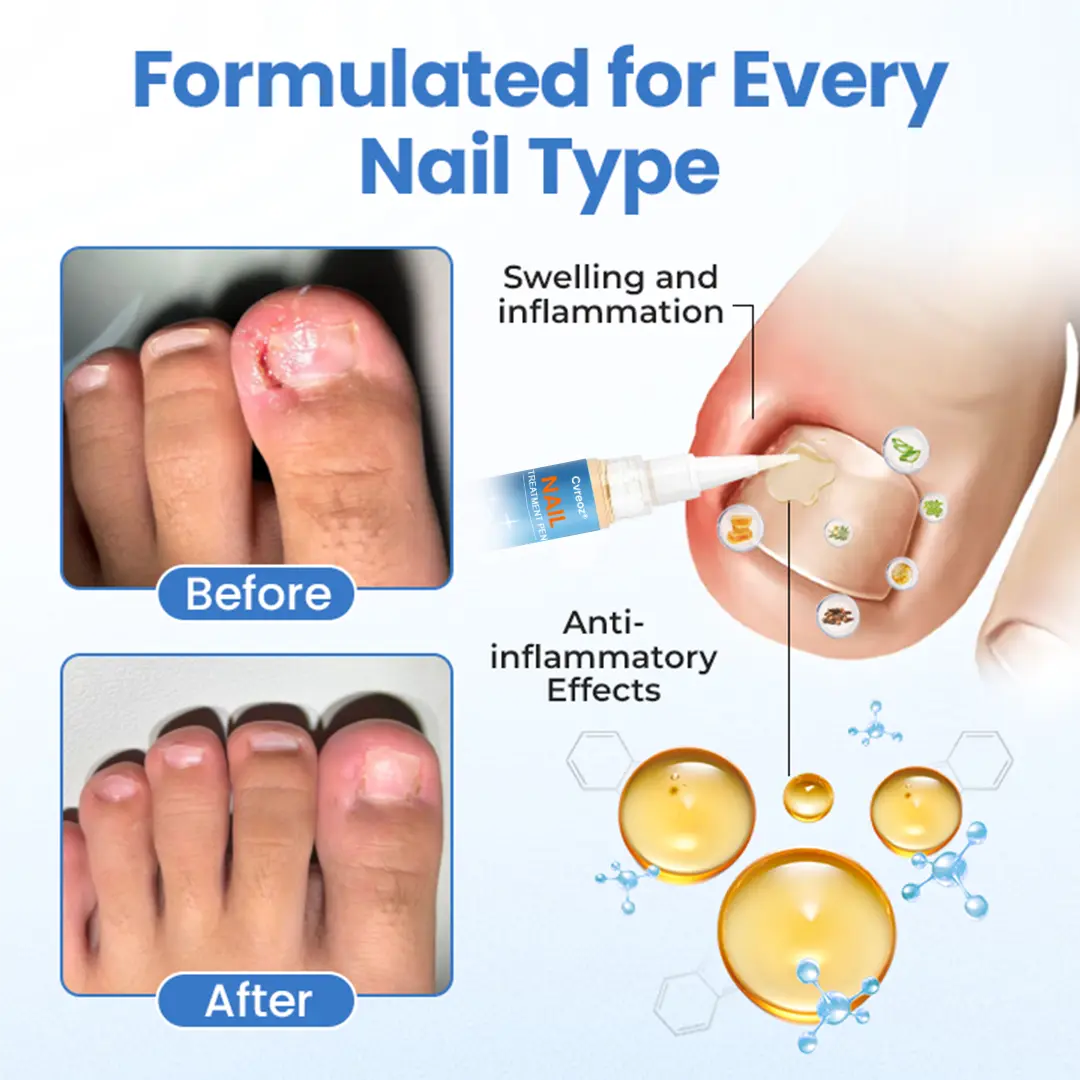 MycoErase Nail Revive Pen - Image 6