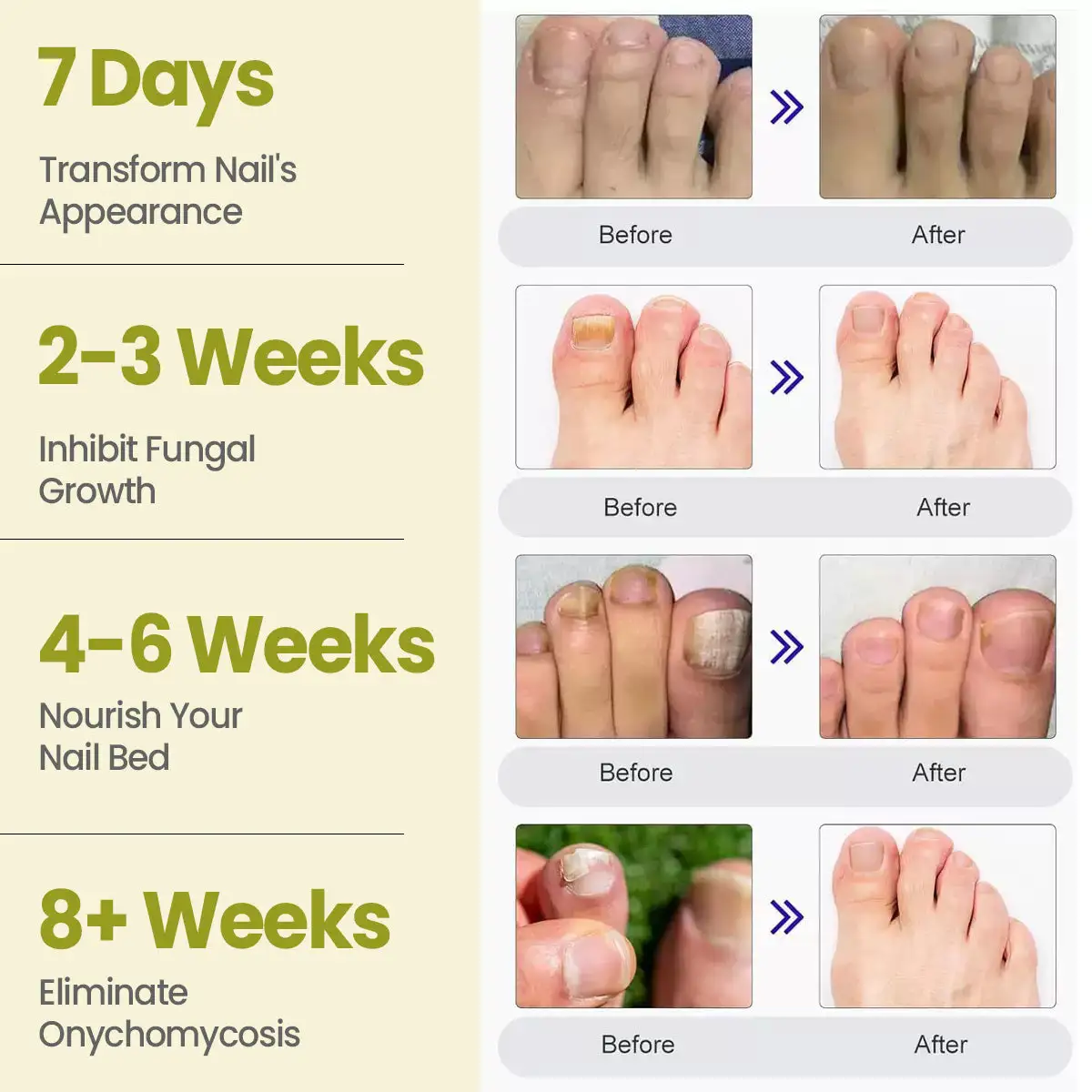 Nail Fungal Patches Pro+ - Image 6