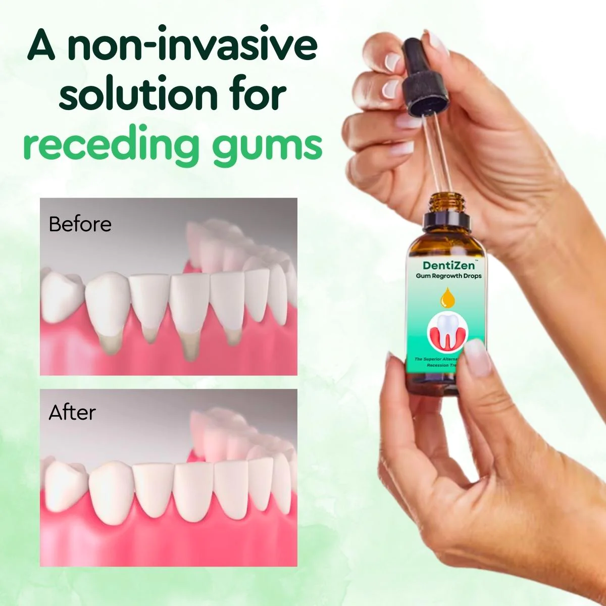 Gum Regrowth Drops - Image 2