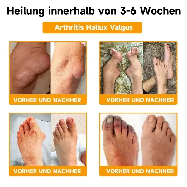 Bienengift- und Kurkuma-Gelenk- und Knochenschmerzlinderungscreme - Image 5