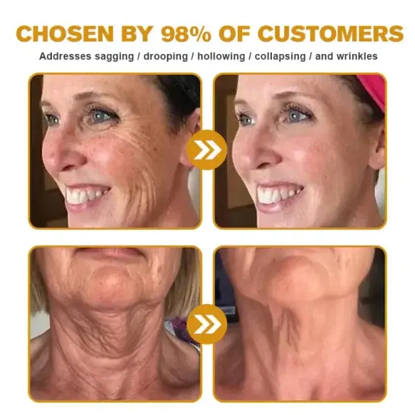 Botox Bee Venom Wrinkle Remover Cream - Image 3