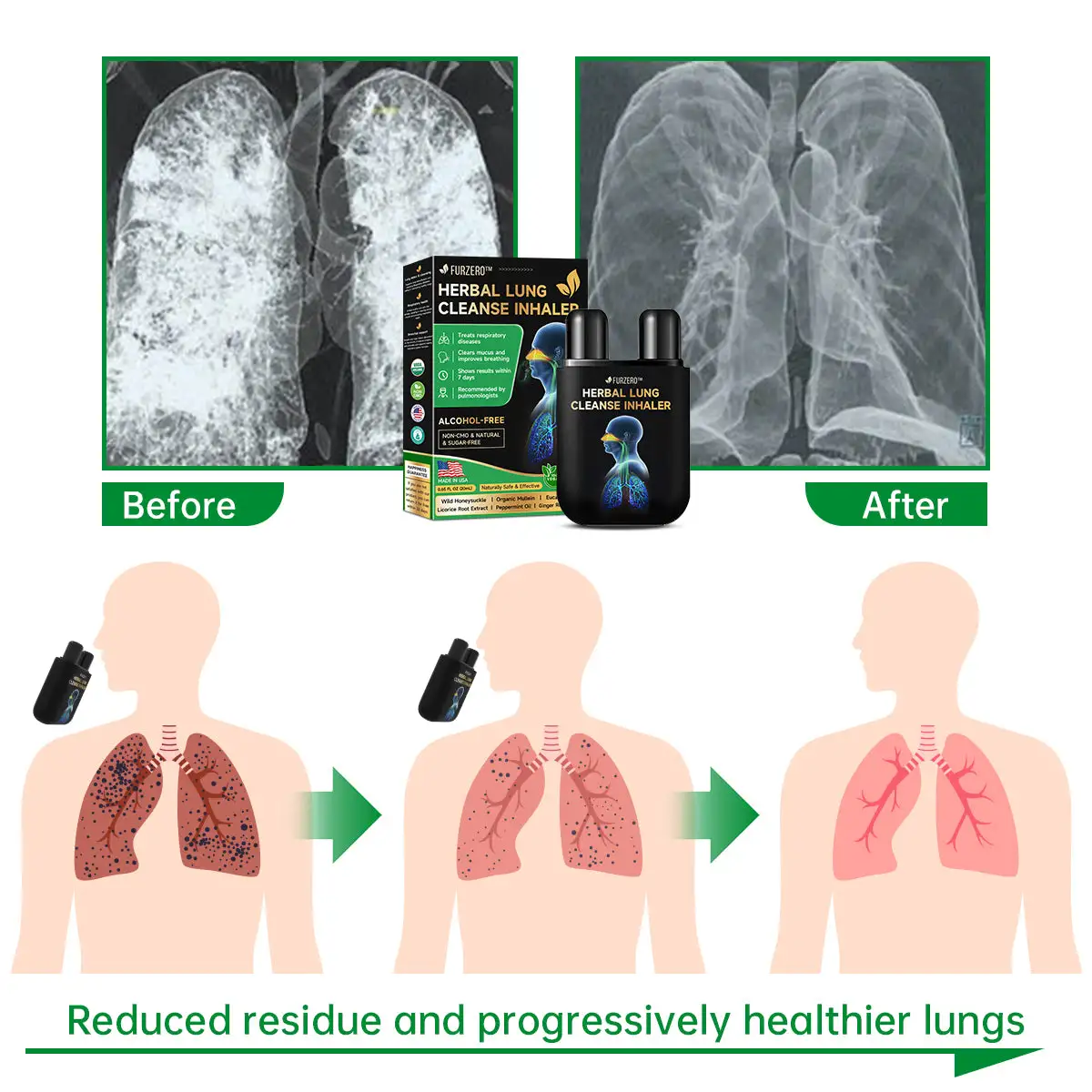 Lung Mucus Cleansing Inhaler - Image 6