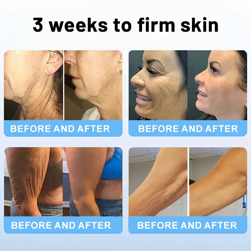 Oligopeptide-Infused Skin Firming Cream - Image 3