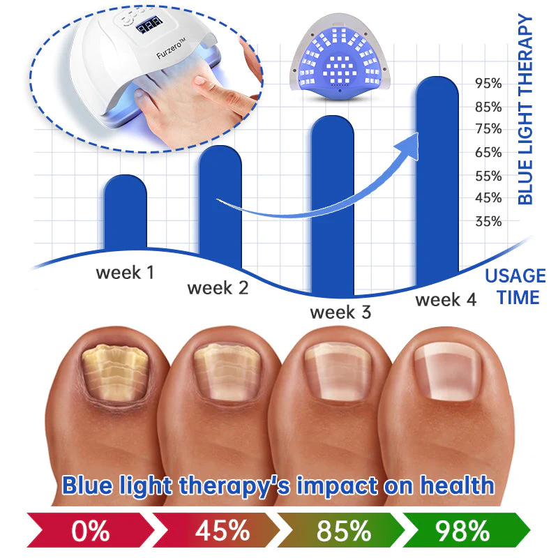PureNail Fungus Laser Therapy Device - Image 4