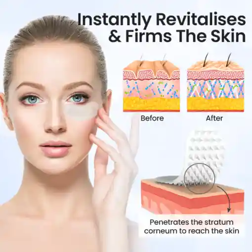 Hyaluronic Acid Microneedle Patch