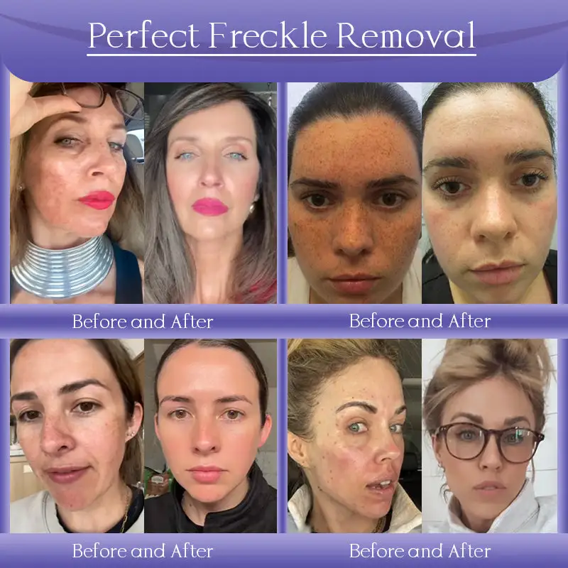 Anti-Wrinkle Skin Cream for Remove Wrinkles - Image 4