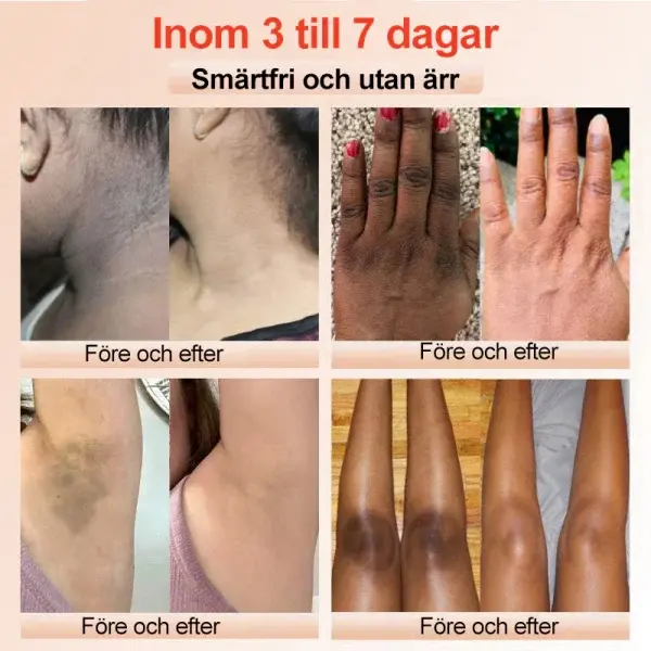 Purifying Peeling Gel - Image 2