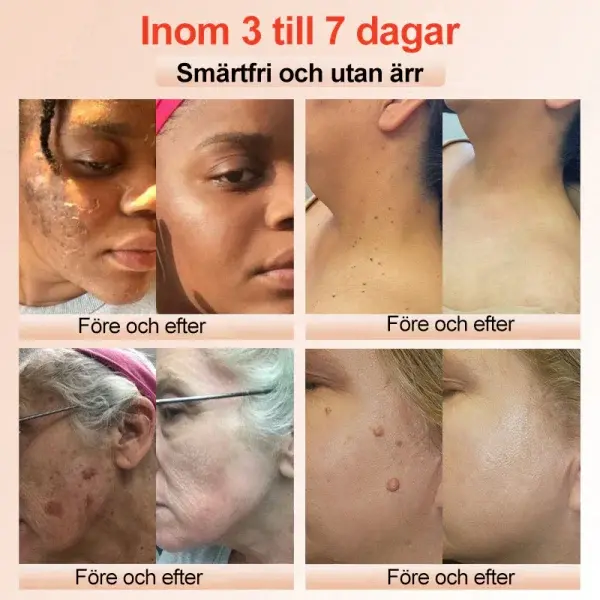 Purifying Peeling Gel - Image 4