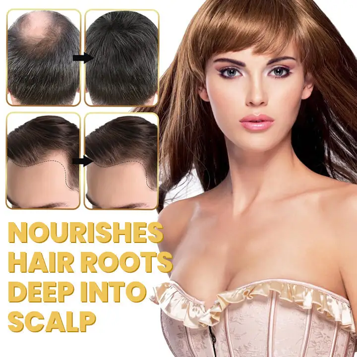 Spray-on Hair Growth Essence - Image 13