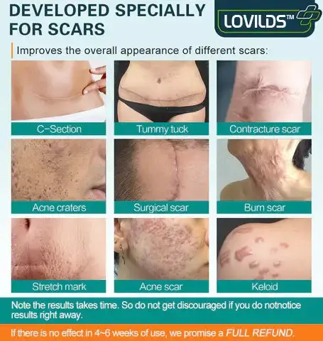 Advanced Scar Spray For All Types of Scars - Image 2