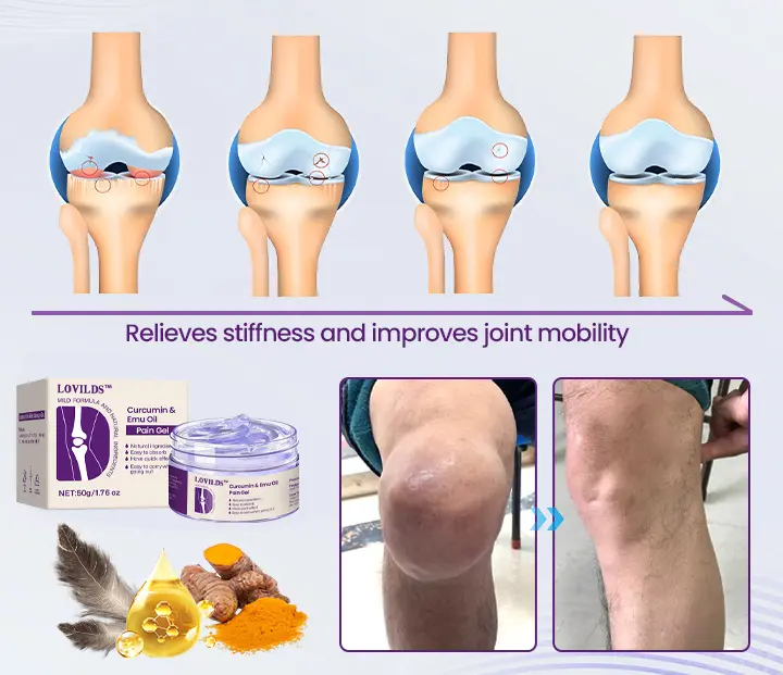 Curcumin & Emu Oil Pain Gel - Image 9