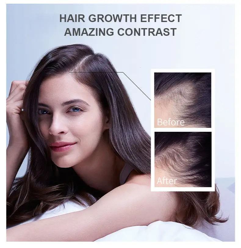 Hair Growth Essence - Image 6