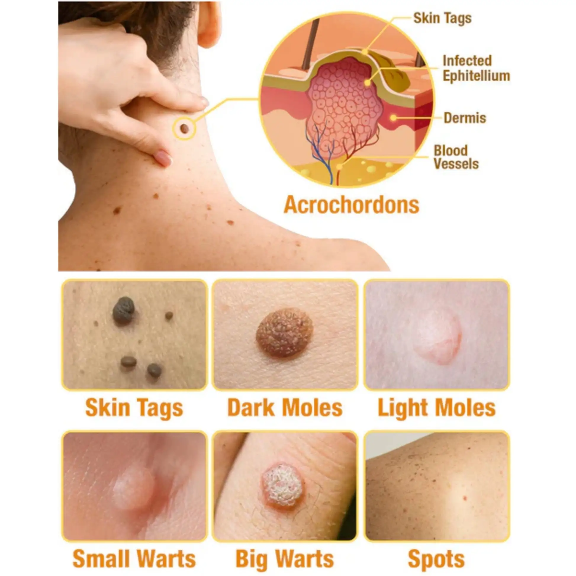 TagRecede Bee Venom Treatment Spray - Image 4